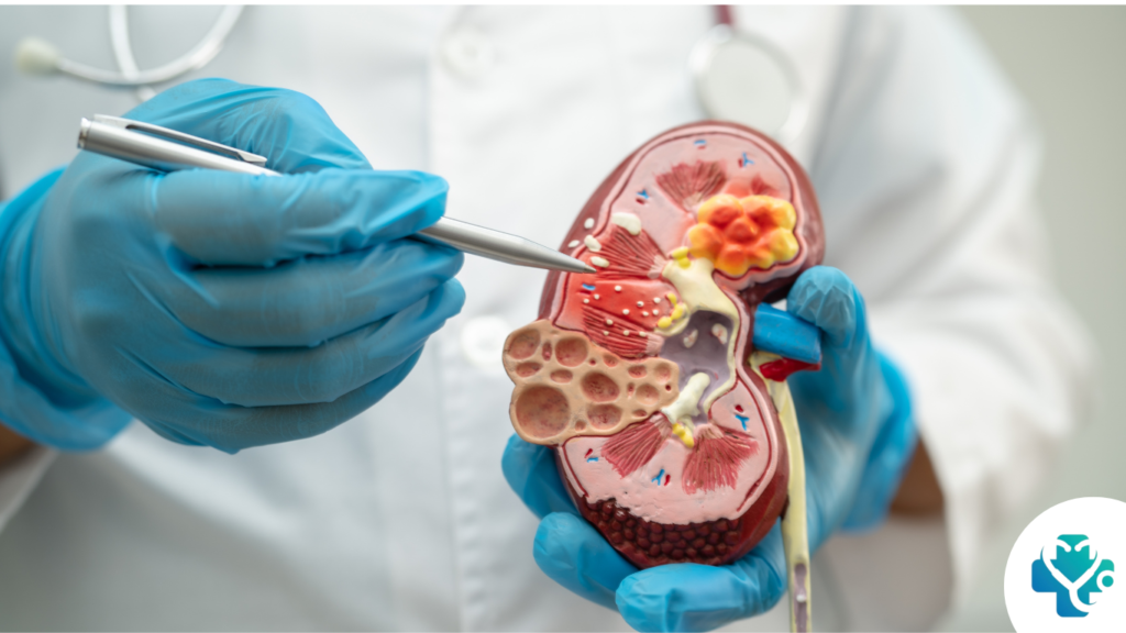 Early Signs of Kidney Damage