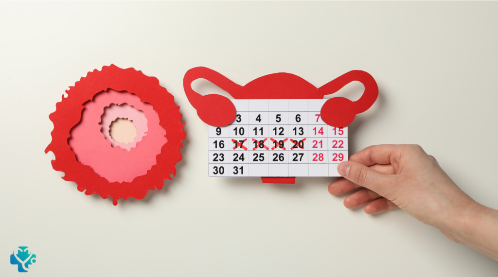 Irregular Periods